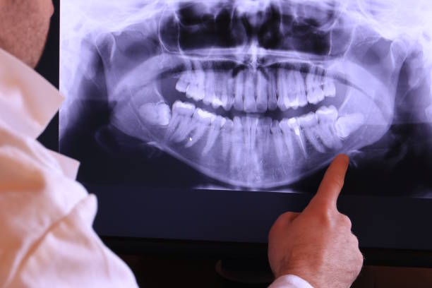 Best Emergency Root Canal Treatment in Cherokee Village, AR